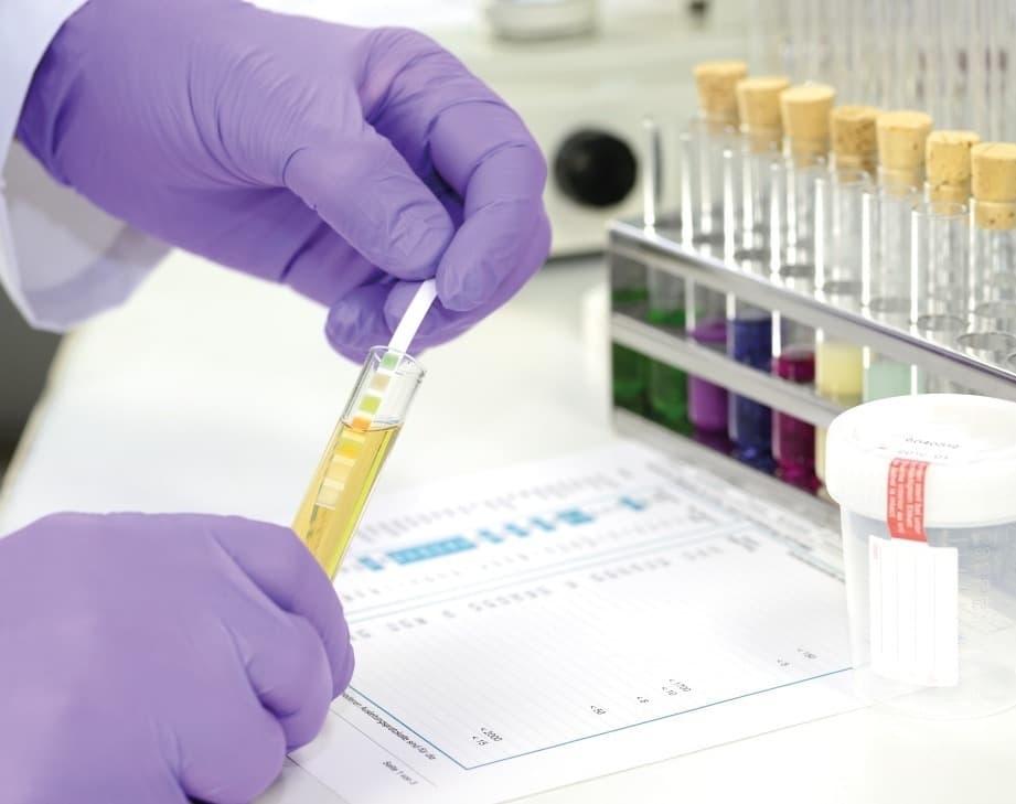 Drug and Alcohol Monitoring